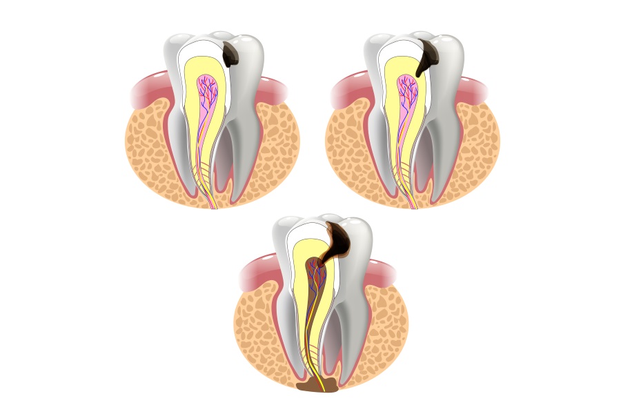 odontologia-conservadora